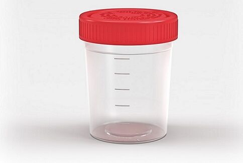 container for testing parasites