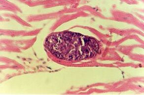 parasite