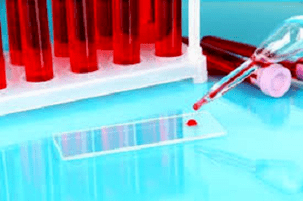 Blood examination
